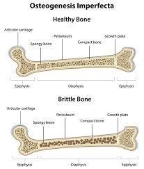 osteogenesis