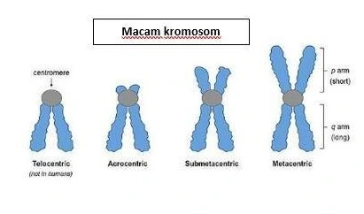 bentuk kromosom